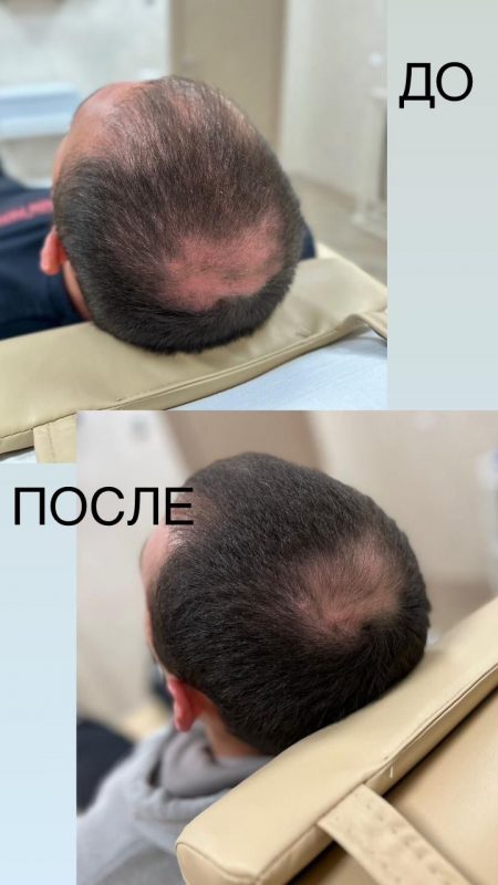 Эффект после процедуры (3) Эффект после процедуры (3)